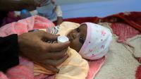 Un nourrisson souffrant de malnutrition dans un hôpital de la ville portuaire de Hodeidah au Yémen, le 3 décembre 2017 [ABDO HYDER / AFP/Archives]