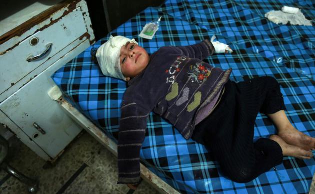 Un enfant syrien est soigné dans un hôpital de Douma, dans la Ghouta orientale, le 3 mars 2018 [HAMZA AL-AJWEH / AFP]