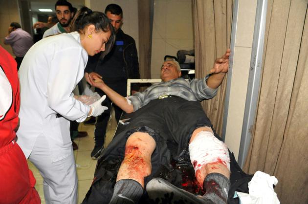 Photo fournie par l'agence de presse officielle syrienne Sana le 7 avril 2018 montrant un homme blessé recevant des soins dans un hôpital de la capitale syrienne Damas après des tirs de roquettes [STRINGER / SANA/AFP]