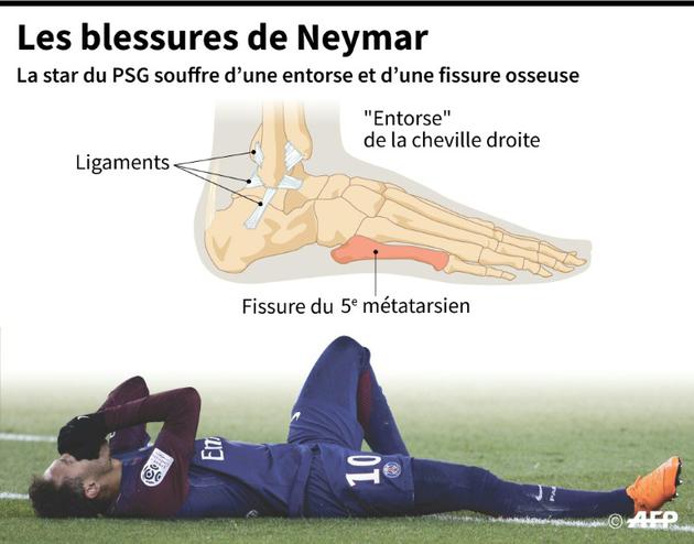 La star du PSG Neymar souffre d'une entorse à la cheville droite et d'une fissure sur un os du pied  [Sophie RAMIS / AFP]