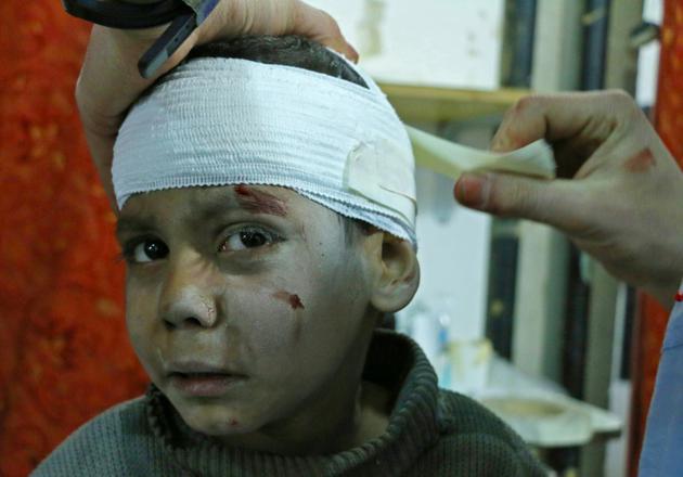 Un enfant syrien est soigné dans une clinique de fortune à Kafr Batna après des bombardements du régime sur les zones rebelles dans la Ghouta orientale, le 6 mars 2018  [Mohammed EYAD / AFP]