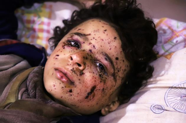 Omar, un garçon de 10 ans blessé dans un raid aérien qui a tué plusieurs membres de sa famille, reçoit des soins dans un hôpital de fortune dans la Ghouta orientale, une enclave rebelle près de Damas bombardée par le régime syrien le 25 février 2018 [AMER ALMOHIBANY / AFP]